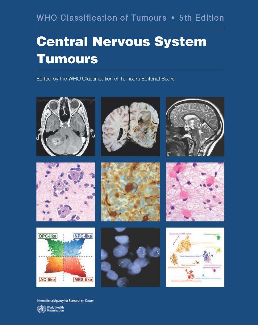 Central Nervous System Tumours: WHO Classification of Tumours 5th Edition